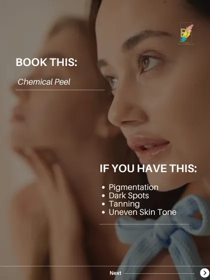 If you are dealing with pigmentation, dark spots, tanning, or an uneven skin tone, a chemical peel is one of the primary treatments I would consider. It provides controlled exfoliation to lift away pigmented cells from the skin's surface.