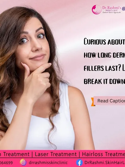 An informational graphic breaking down the longevity of different types of dermal fillers, including Hyaluronic Acid (HA), Calcium Hydroxylapatite (CaHA), and Poly-L-Lactic Acid (PLLA).