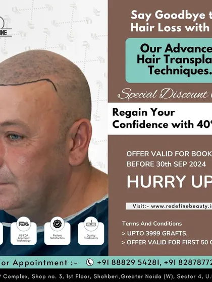 Regain your confidence with our special discount offer on advanced hair transplant techniques. Book your appointment soon to take advantage of this limited-time opportunity.