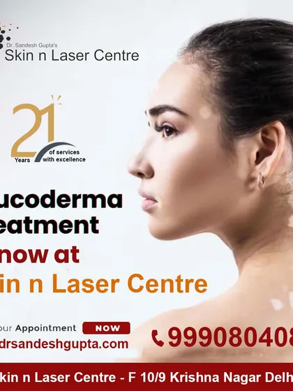 As a recognized dermatologist, I offer advanced treatments for managing Vitiligo at my Skin n Laser Centre. We have a progressive method for treating white spots and pigmentation marks.