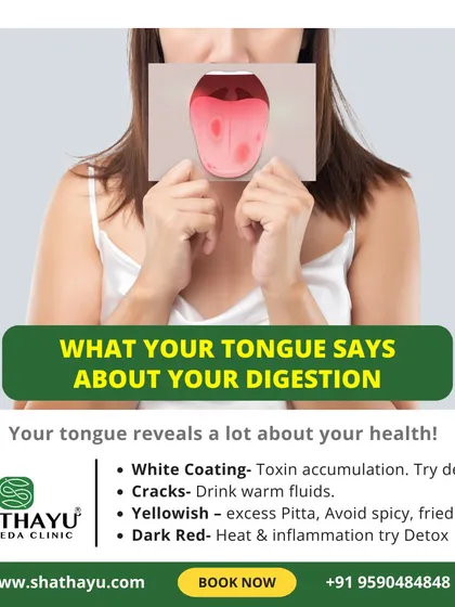 In Ayurveda, the tongue is a map of your internal health. A white coating can indicate toxin accumulation, while a yellowish hue suggests excess Pitta. We use tongue diagnosis as a key tool to understand your digestive state.