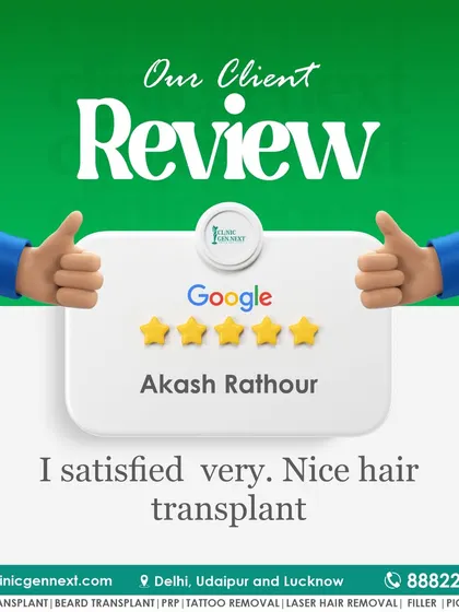 Akash Rathour's review is short and sweet: "I satisfied very. Nice hair transplant." A happy patient with a great result is always my ultimate goal.