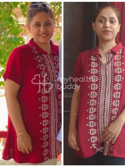 This new mom lost 12 kgs in 3 months, starting 4.5 months after her C-section. The diet and exercise plan was simple and tailored to her postpartum needs.