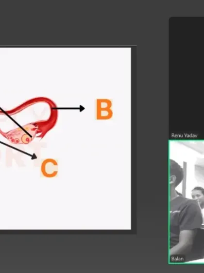 Using diagrams of the female reproductive system, we provide clear, scientific information to coaches. This foundational knowledge helps demystify menstruation and empowers coaches to have informed conversations.