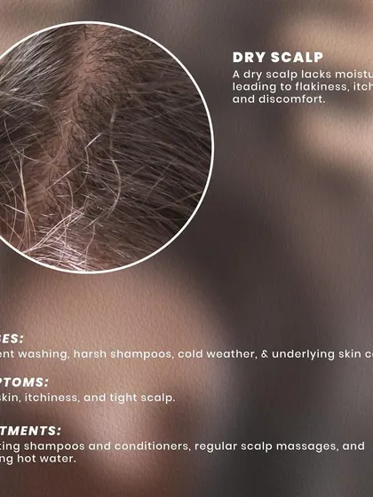 A dry scalp lacks moisture, leading to flakiness and discomfort. This can be caused by frequent washing with harsh shampoos or cold weather, and is treated with hydrating products and scalp massages.