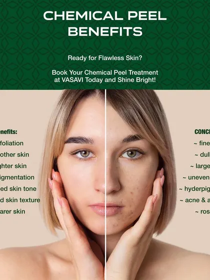 A visual guide to the benefits of chemical peels versus the concerns they address. Peels provide exfoliation for smoother, brighter, and clearer skin, effectively targeting issues like fine lines, dullness, large pores, hyperpigmentation, and acne.