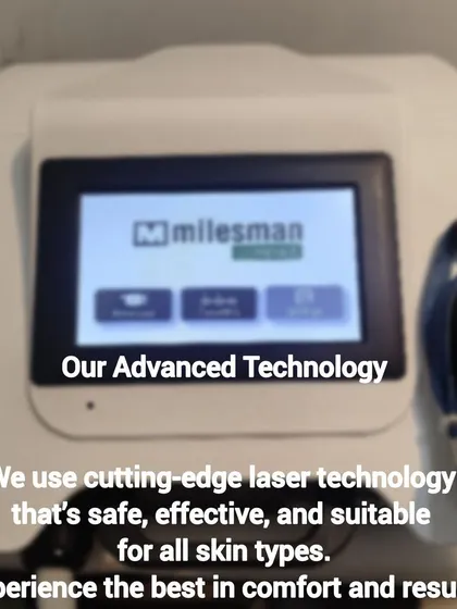 This is the Milesman laser, a key part of our advanced, USFDA-approved technology. We invest in cutting-edge equipment to ensure your treatments are not only effective for Indian skin types but also safe and comfortable.