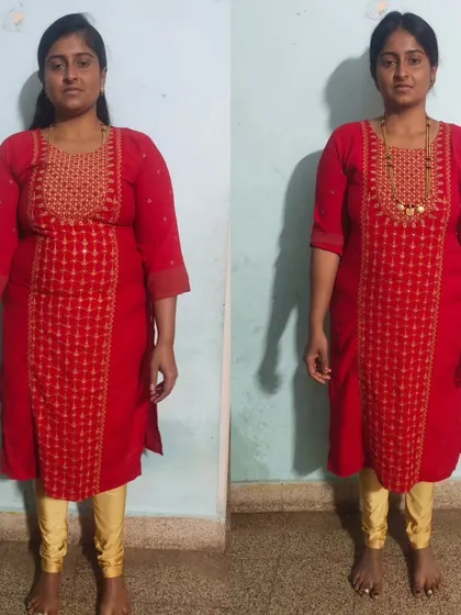The front view of Ms. Chaithra's transformation. Her success in reversing PCOD and losing fat was achieved in just 3 months with a home workout and natural diet.