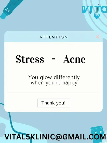 The connection is real: Stress = Acne. Your emotional well-being directly affects your skin's health. You glow differently when you're happy and your body is not in a state of chronic stress.