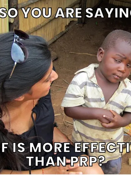 Yes, it's true. PRF is significantly more effective than PRP. The key reason is the concentration of platelets. PRF contains about 10 times the platelet concentration found in the body, compared to just 2 to 5 times for PRP, leading to a much more powerful healing and growth response.