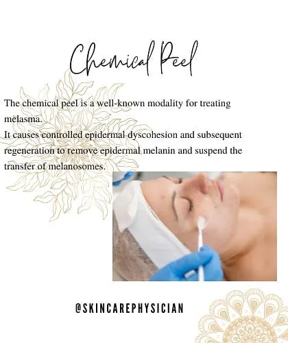 Chemical peels are a well-known and effective modality for treating melasma. They work by causing controlled exfoliation of the top layer of skin, which helps remove epidermal melanin and regenerate healthier skin.