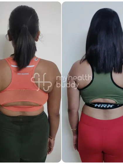 The back view of this 5kg transformation shows a noticeable improvement in body composition and toning.