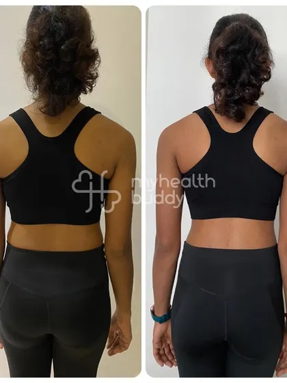 This client lost 4 kgs in 3 months, focusing on reducing belly fat and gaining muscle. She broke the myth that eating meat leads to weight gain by following an animal-based protein diet.