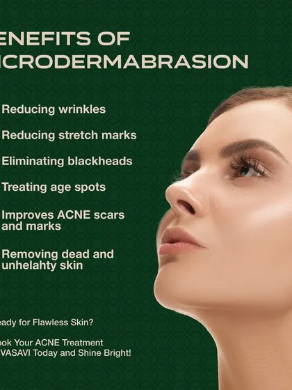 This graphic summarizes the benefits of microdermabrasion. It is effective for reducing the appearance of wrinkles and stretch marks, eliminating blackheads, treating age spots, and improving acne scars by removing dead and unhealthy skin.