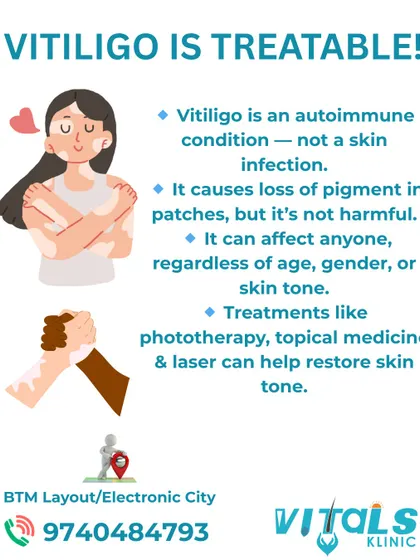 This infographic provides essential facts about vitiligo. It clarifies that it is a non-harmful autoimmune condition and that treatments like phototherapy and laser can help restore skin tone, aiming to replace judgment with understanding.