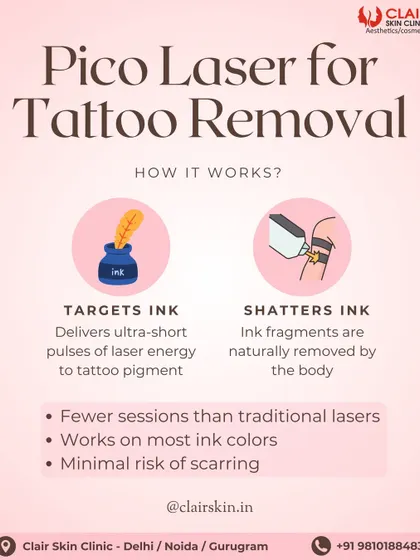 This explains how our Pico Laser tattoo removal works. The laser delivers ultra-short energy pulses that specifically target and shatter ink particles, which are then naturally cleared by your body. This technology means fewer sessions and better results on most ink colors.