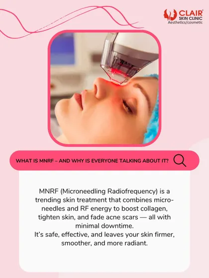 What is MNRF and why is everyone talking about it? This graphic explains that it's a trending treatment combining microneedles and RF energy to boost collagen, tighten skin, and fade acne scars with minimal downtime.