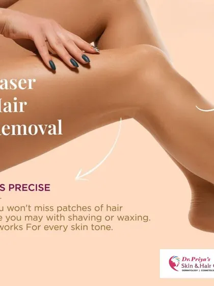 Laser hair removal is a precise treatment that targets hair follicles without missing patches, unlike shaving or waxing. It is a reliable method that I adapt for every skin tone.