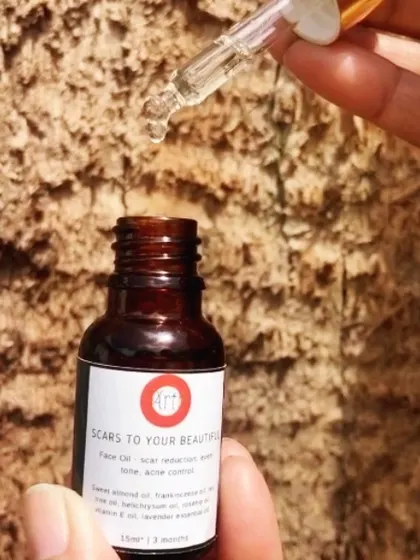 My 'Scars to Your Beautiful' face oil is a powerful blend of oils that helps reduce the appearance of scars, evens skin tone, and controls acne. Just a few drops are all you need.