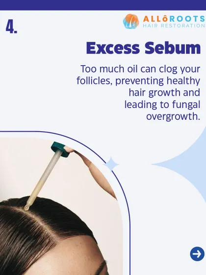 Your scalp naturally produces oil, or sebum, but too much of it can be a problem. Excess sebum can clog hair follicles, which prevents healthy hair growth and can even lead to fungal issues.