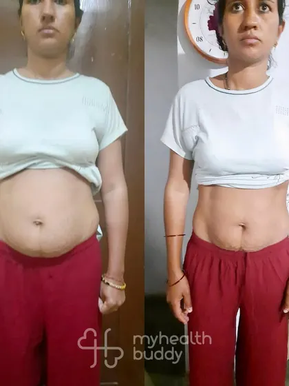 This mom of two toddlers healed her diastasis recti and fatty liver while losing 4 kgs in 3 months. She followed a simple plan with home-cooked food and saw amazing results.