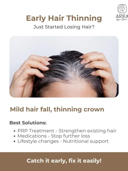 If you've just started noticing hair thinning, now is the best time to act. Early intervention with treatments like PRP, supportive medications, and lifestyle adjustments can effectively strengthen existing hair and prevent further loss.