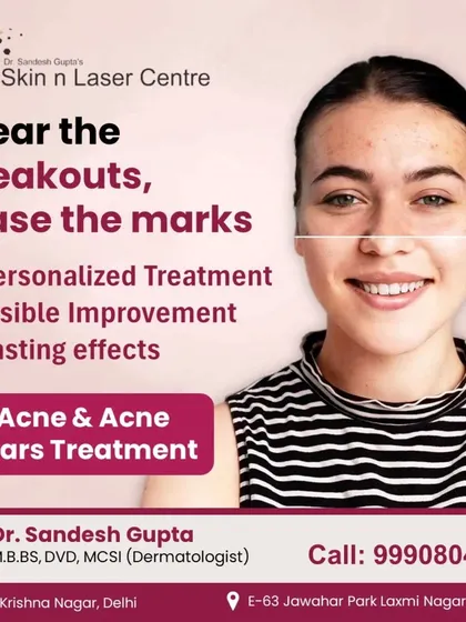 Clear the breakouts, erase the marks. My clinic offers personalized treatment for acne and acne scars, delivering visible improvement and lasting effects for clear, confident skin.