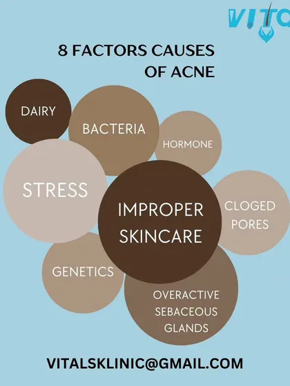 Acne is a multifactorial condition. This infographic illustrates eight common contributing factors, including hormonal shifts, bacteria, stress, genetics, and improper skincare, highlighting why a comprehensive diagnosis is key to successful treatment.