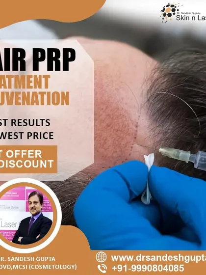 PRP is not just for hair; it's also one of the best treatments for acne scars. At my clinic, I offer this effective procedure starting at an affordable price to help you achieve smoother skin.