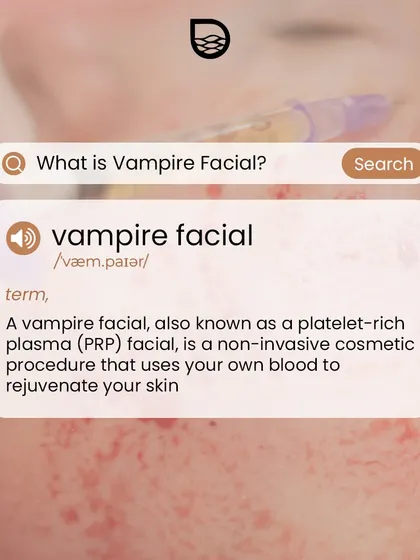 This visual defines the 'Vampire Facial' in a dictionary format. It demystifies the term, explaining it is a non-invasive cosmetic procedure that uses your own blood to rejuvenate your skin.