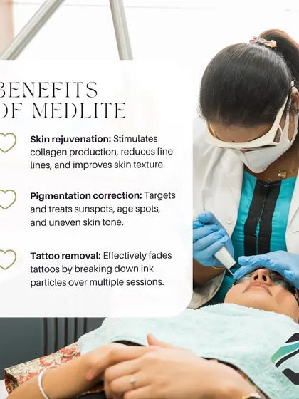 The Medlite laser offers multiple benefits: it stimulates collagen for skin rejuvenation, corrects pigmentation like sunspots, and can even be used for tattoo removal by breaking down ink particles.