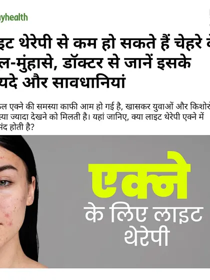 The headline from our feature in Onlymyhealth, where our expert, Ritu Khariyan, explains the benefits and precautions of using light therapy to treat pimples and acne.