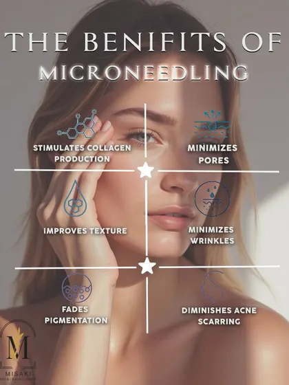 This graphic illustrates the powerful benefits of microneedling, including stimulating collagen, minimizing pores and wrinkles, and diminishing acne scarring.