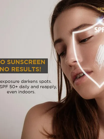 No sunscreen, no results. This visual emphasizes that sun exposure darkens spots and that daily SPF 50+ is essential, even indoors.