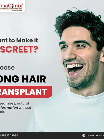 Want to make your transformation discreet? Choose our Long Hair Transplant for a seamless, natural look without the wait. It is the preferred method for public figures and professionals.