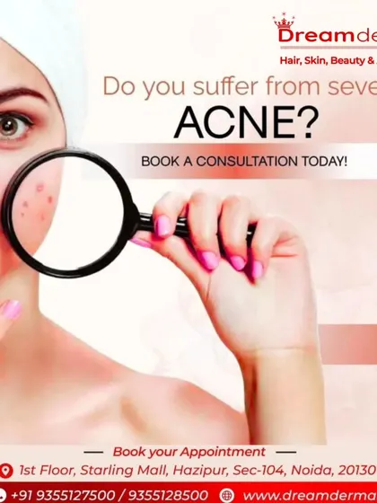 If you suffer from severe or persistent acne, a professional consultation is essential. We use diagnostic tools to look closer at your skin and determine the most effective course of action for you.