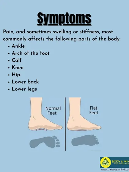 A repeat of the flat feet symptoms infographic.
