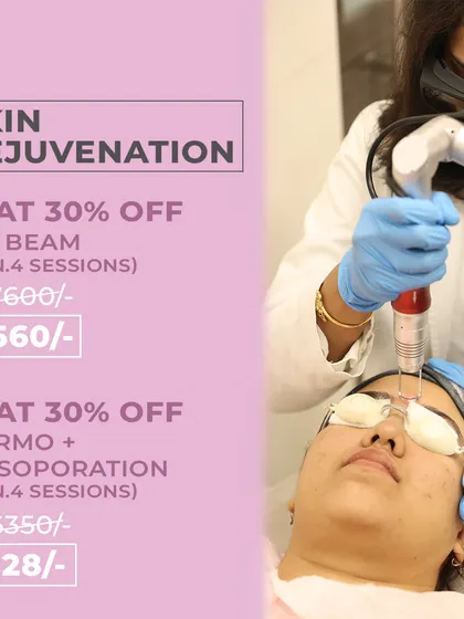 A client undergoing a Tri-Beam laser session for skin rejuvenation. This treatment is highly effective for reducing pigmentation and improving overall skin tone and texture.