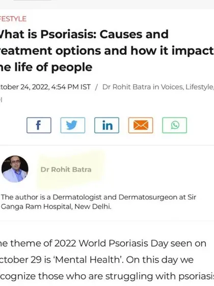 I regularly contribute to leading publications to educate the public on important skin health topics. This is a screenshot of my article on Psoriasis for the Times of India, where I discuss its causes, treatments, and impact on mental health.