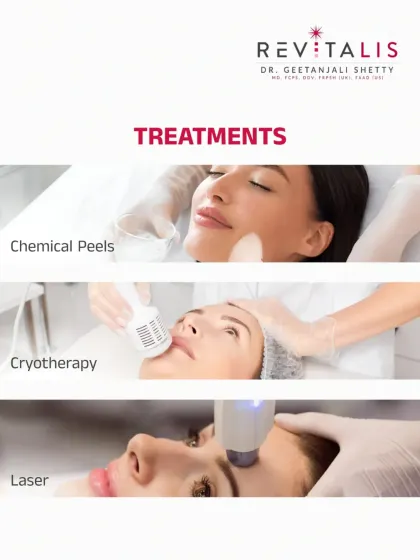 Professional Treatments for Milia Removal. Since milia cannot be popped, professional removal is necessary. I offer safe and effective treatments like chemical peels, cryotherapy, and laser to remove them.