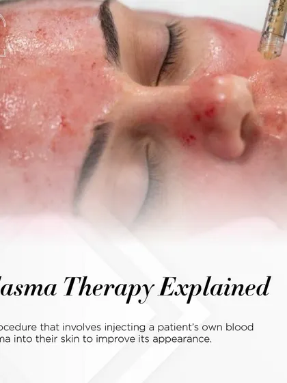 Plasma Therapy (PRP) explained: a procedure that involves injecting a patient's own blood plasma to naturally improve skin appearance.