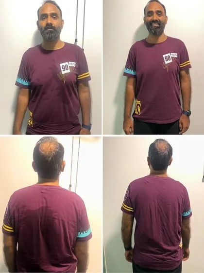 The front and back views of Chandrashekhar's transformation highlight the physical changes that came with a new mindset and consistent effort.