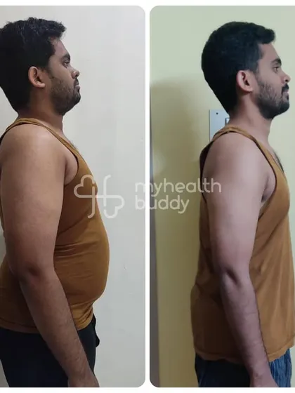 Another side profile of Gowtham's incredible 6-month transformation.
