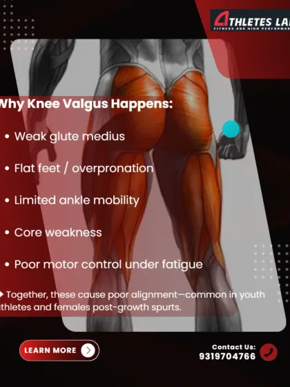 We explain the common causes of knee valgus, which include weak gluteus medius muscles, limited ankle mobility, and poor motor control. These factors are particularly common in youth athletes and post-growth spurt females.