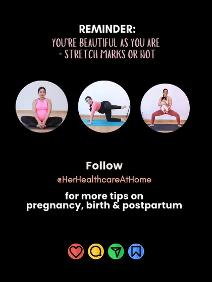A final reminder: you are beautiful as you are, stretch marks or not. Your body has done something incredible.