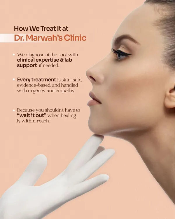 Your skin is your body's first line of defense. This graphic explains my approach to treating skin conditions: we diagnose at the root with clinical expertise, provide evidence-based treatments, and handle every case with empathy because you shouldn't have to "wait it out."