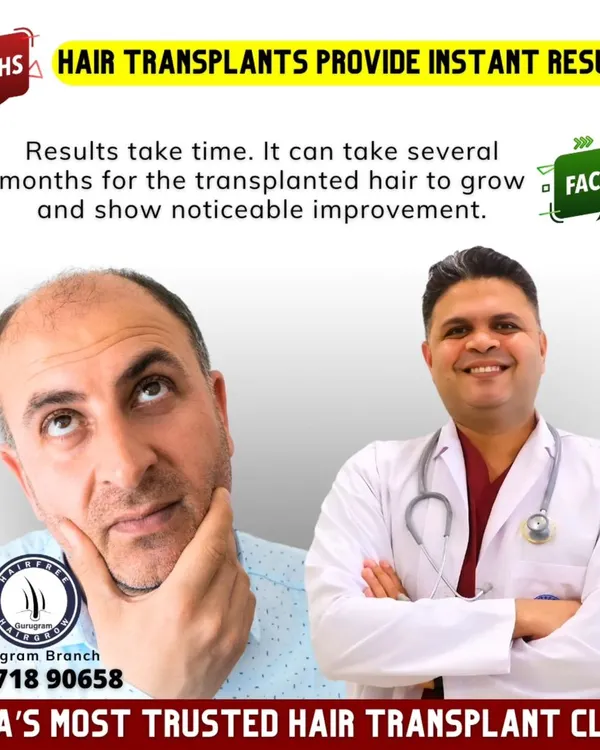**Myth:** Hair transplants provide instant results. **Fact:** This is a long-term solution. It takes several months for the new hair to grow and for you to see the noticeable, final improvement. Patience is key.
