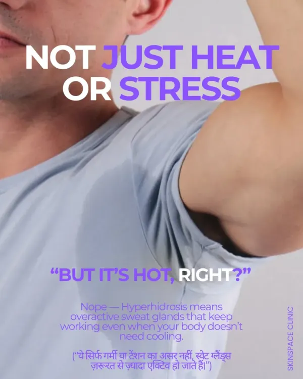 If you sweat excessively even when you are not hot or stressed, you may have hyperhidrosis. This is a medical condition caused by overactive sweat glands, and it is treatable.