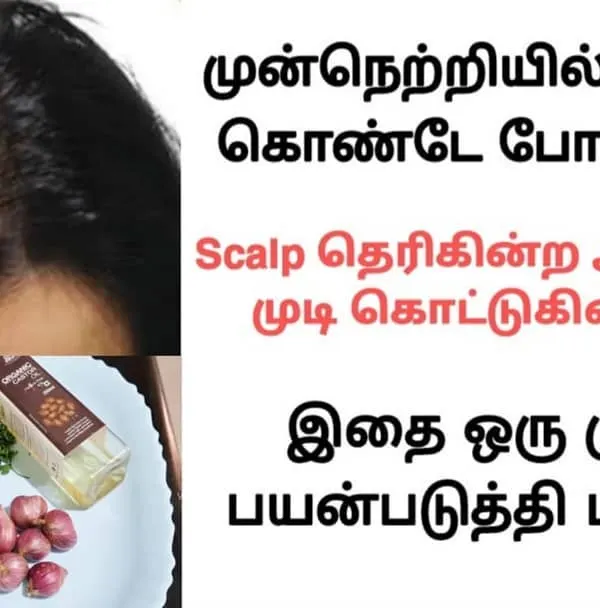 This remedy is for those experiencing hair loss and a visible scalp. I show how to use natural ingredients like onion and herbs to address this.