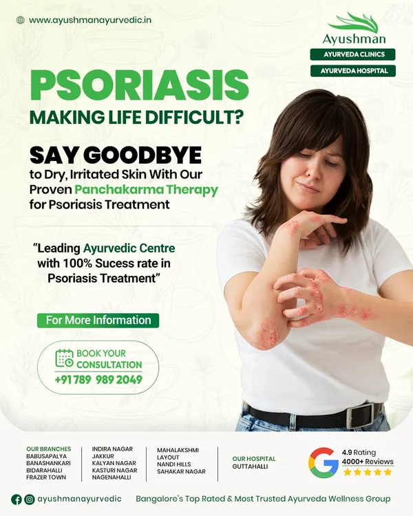 For those struggling with Psoriasis, our proven Panchakarma therapy offers a path to relief. We focus on internal purification to address the autoimmune response, helping you say goodbye to dry, irritated skin with a high success rate.